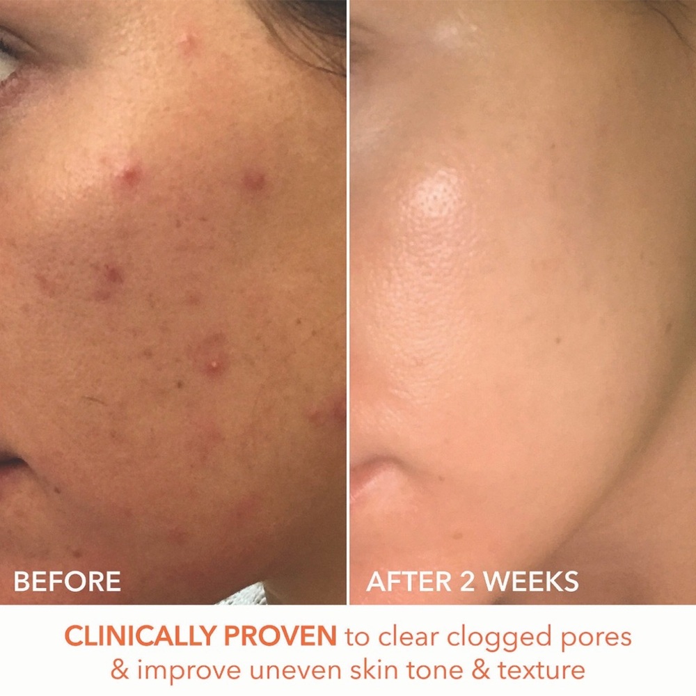 3 for $30-Dr Dennis Gross Alpha Beta Extra Strength Daily Peel Pads - Picture 6 of 16